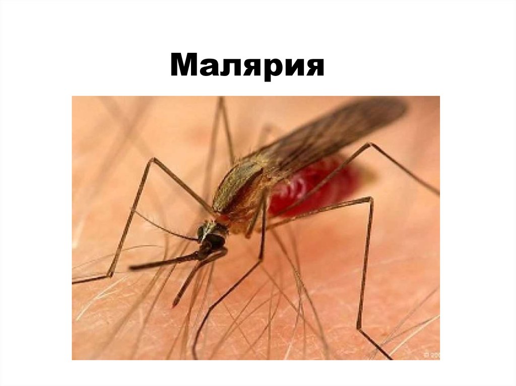 Малярия какая болезнь. Малярия паразитарное заболевание.